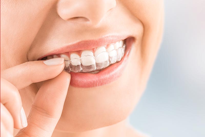 Tooth Extraction